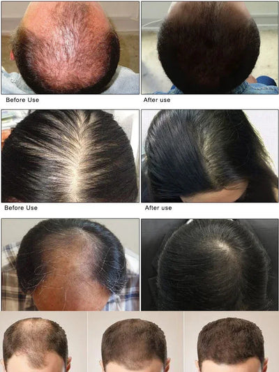 Hair Growth Hair Loss Scalp Serum