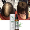 Anti Hair Loss Fast Regrowth Thicken Scalp Treatment Oils