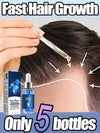 Hair Growth Hair Loss Scalp Serum