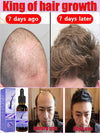 Fast Hair Growth Essence Effective Serum