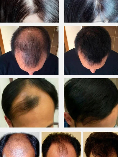 Hair Growth Hair Loss Scalp Serum